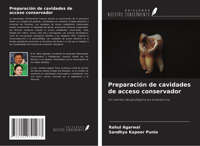 Preparación de cavidades de acceso conservador