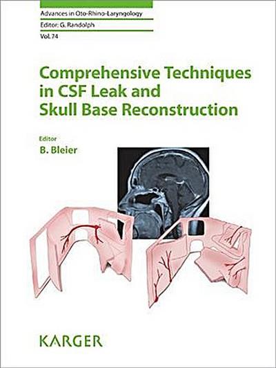 Comprehensive Techniques in CSF Leak Repair and Skull Base Reconstruction