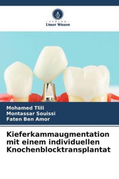 Kieferkammaugmentation mit einem individuellen Knochenblocktransplantat