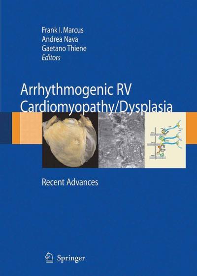 Arrhythmogenic RV Cardiomyopathy/Dysplasia