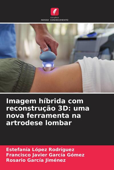 Imagem híbrida com reconstrução 3D: uma nova ferramenta na artrodese lombar