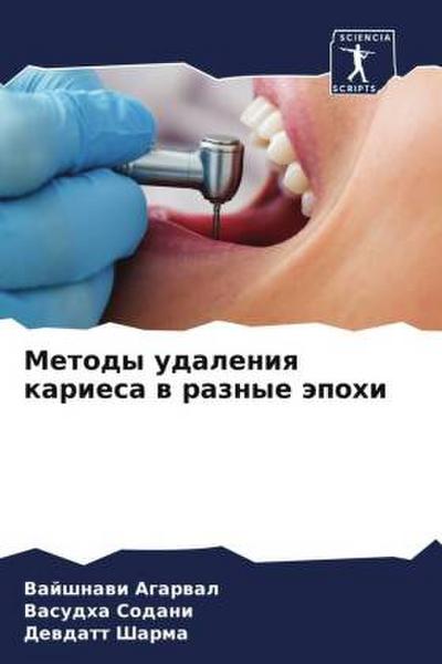 Metody udaleniq kariesa w raznye äpohi