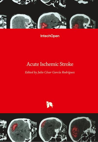Acute Ischemic Stroke