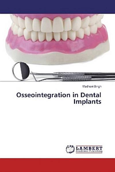 Osseointegration in Dental Implants