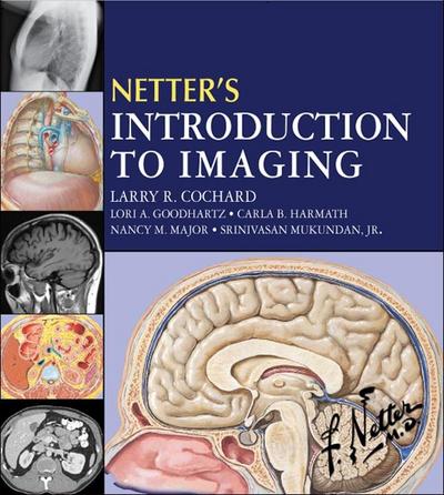 Netter’s Introduction to Imaging E-Book