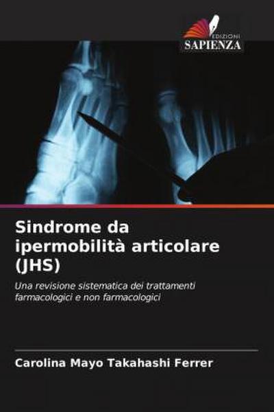 Sindrome da ipermobilità articolare (JHS)