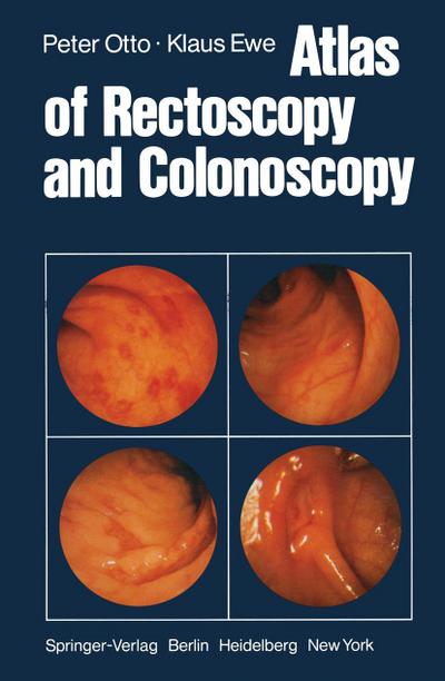 Atlas of Rectoscopy and Coloscopy