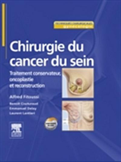 Chirurgie du cancer du sein