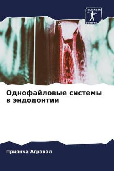 Odnofajlowye sistemy w ändodontii