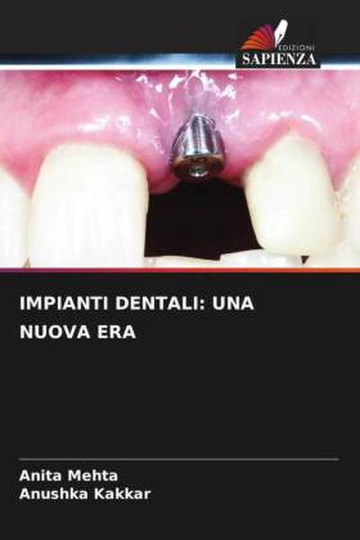 IMPIANTI DENTALI: UNA NUOVA ERA