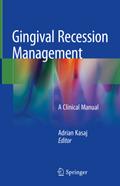 Gingival Recession Management