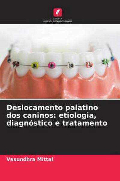 Deslocamento palatino dos caninos: etiologia, diagnóstico e tratamento