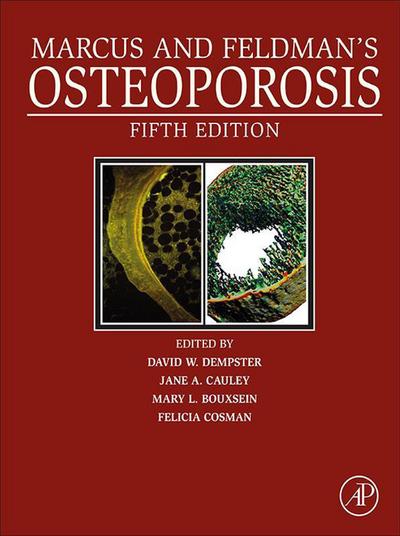 Marcus and Feldman’s Osteoporosis