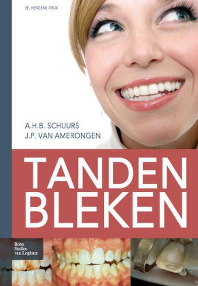 Tanden Bleken