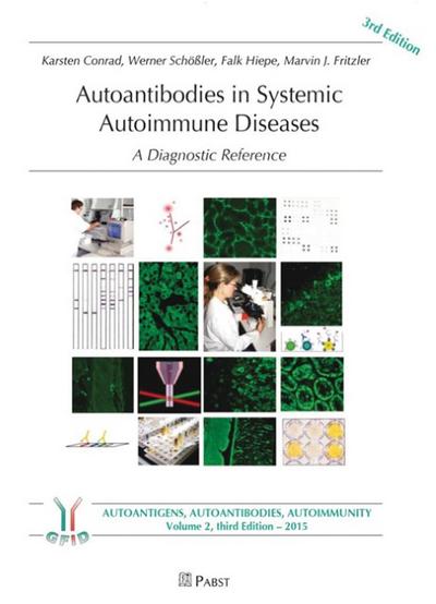 Autoantibodies in Systemic Autoimmune Diseases