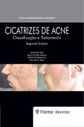 Cicatrizes de Acne