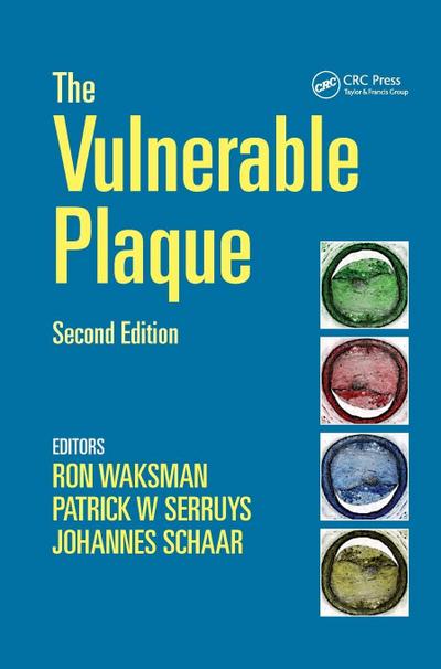 Handbook of the Vulnerable Plaque