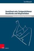 Gezeichnet sein: Fortgeschrittener Brustkrebs und 
