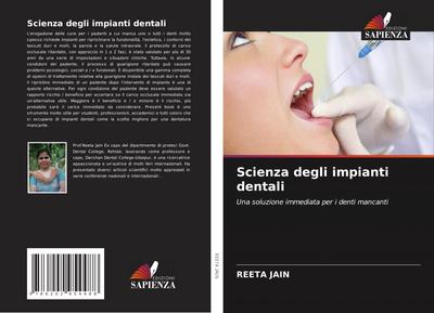 Scienza degli impianti dentali