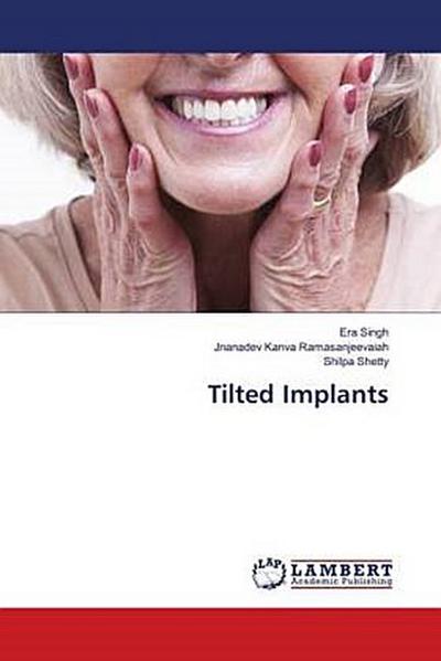 Tilted Implants