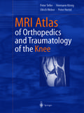 MRI Atlas of Orthopedics and Traumatology of the Knee