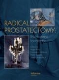 Radical Prostatectomy
