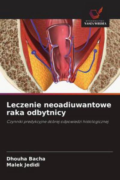Leczenie neoadiuwantowe raka odbytnicy