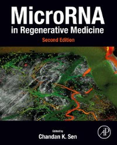 MicroRNA in Regenerative Medicine
