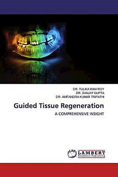 Guided Tissue Regeneration