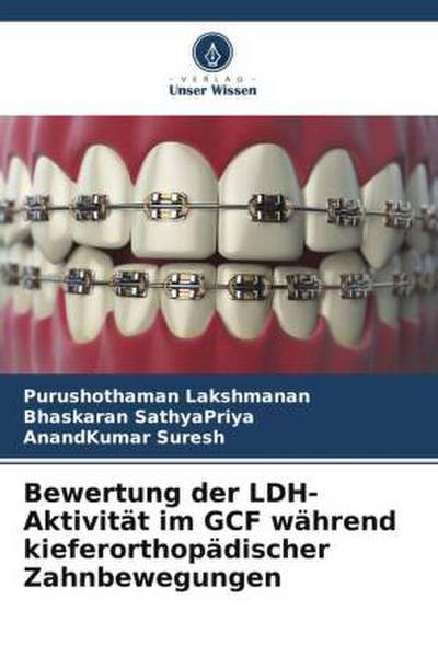 Bewertung der LDH-Aktivität im GCF während kieferorthopädischer Zahnbewegungen