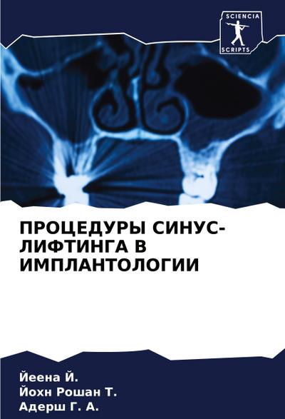 PROCEDURY SINUS-LIFTINGA V IMPLANTOLOGII