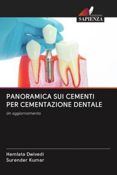 PANORAMICA SUI CEMENTI PER CEMENTAZIONE DENTALE