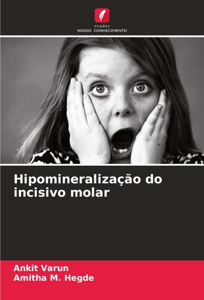 Hipomineralização do incisivo molar