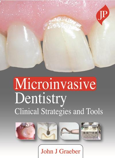Graeber, J: Microinvasive Dentistry