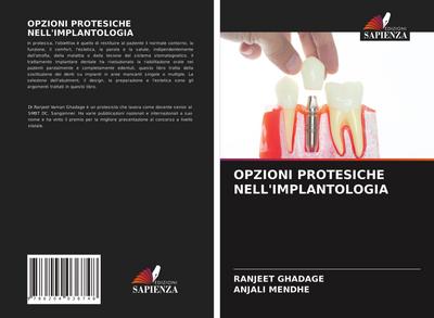 OPZIONI PROTESICHE NELL’IMPLANTOLOGIA