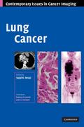 Lung Cancer