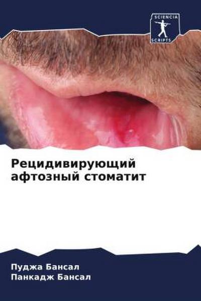 Recidiwiruüschij aftoznyj stomatit
