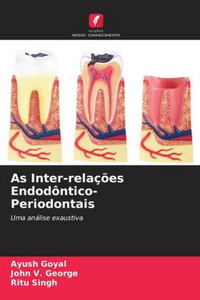 As Inter-relações Endodôntico-Periodontais