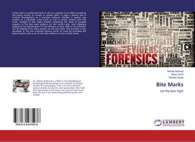 Bite Marks