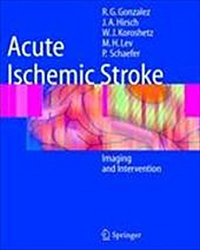 Acute Ischemic Stroke