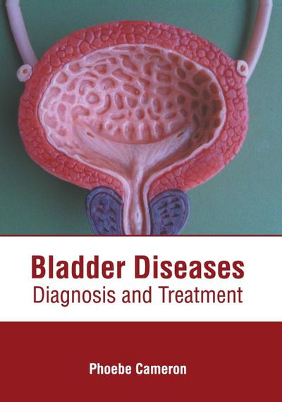 Bladder Diseases: Diagnosis and Treatment