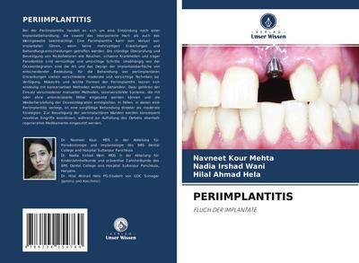 PERIIMPLANTITIS