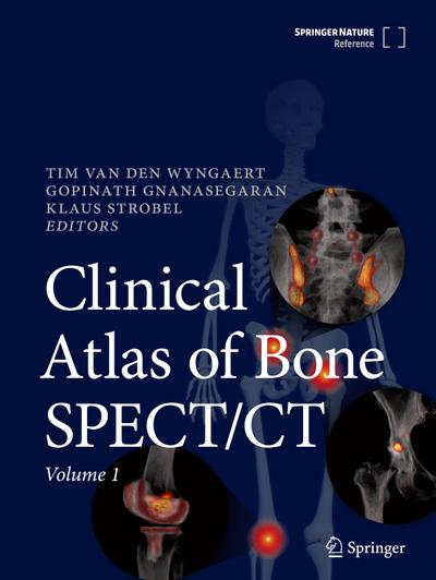 Clinical Atlas of Bone SPECT/CT