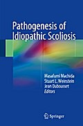 Pathogenesis of Idiopathic Scoliosis