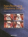Non-Penetrating Glaucoma Surgery