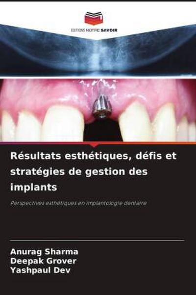 Résultats esthétiques, défis et stratégies de gestion des implants