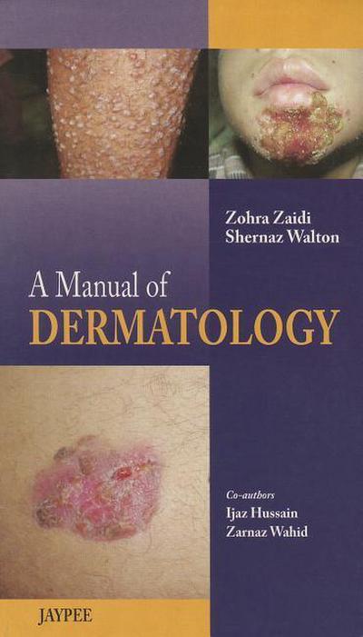 A Manual of Dermatology