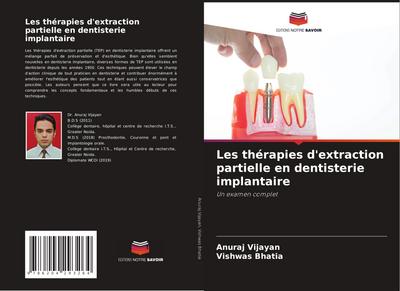 Les thérapies d’extraction partielle en dentisterie implantaire