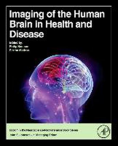 Imaging of the Human Brain in Health and Disease