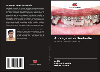 Ancrage en orthodontie